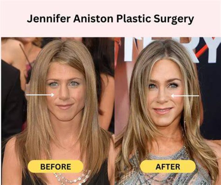What Plastic Surgery Has Shannon Bream Gotten? Body Measurements and